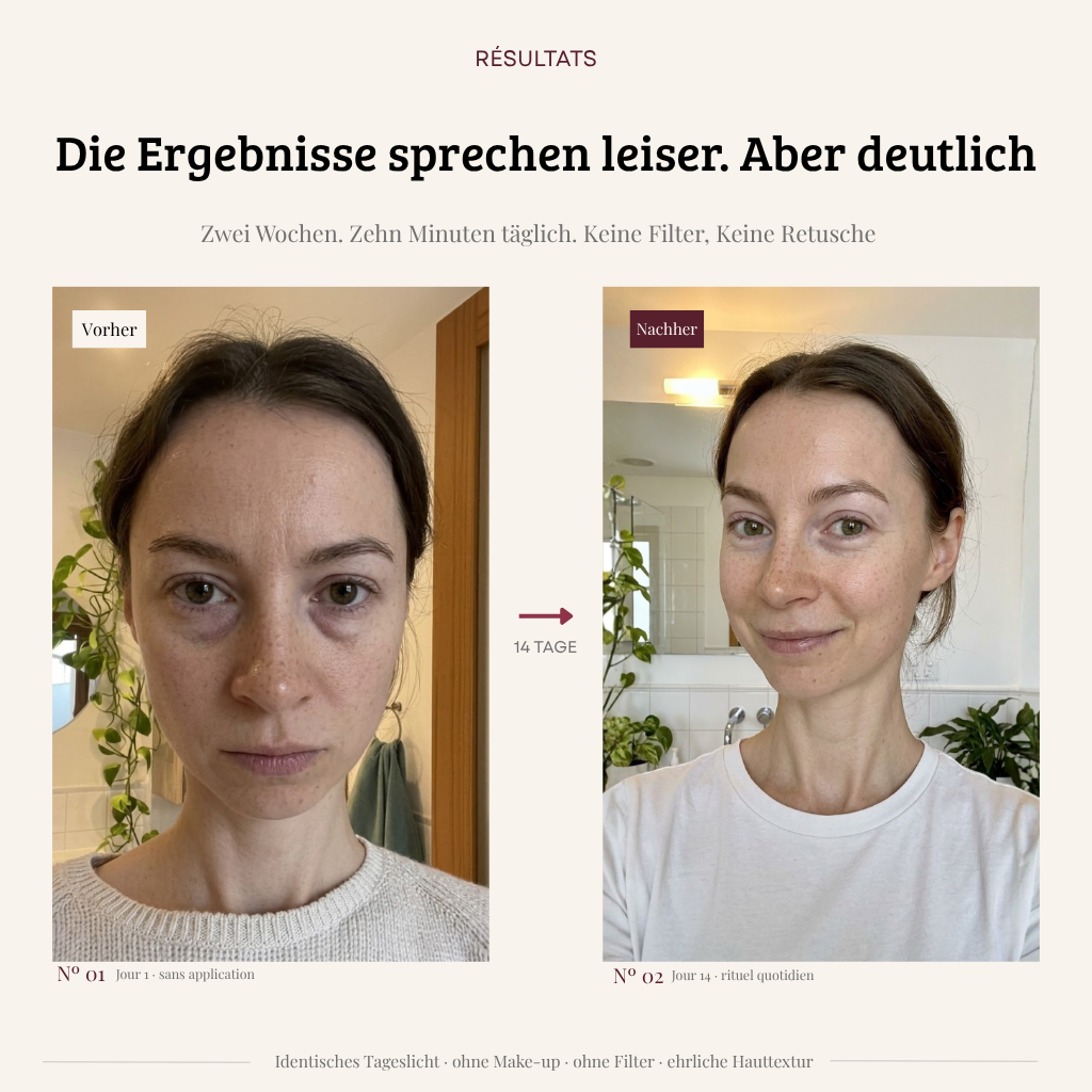 Élan EyeLift 2-in-1