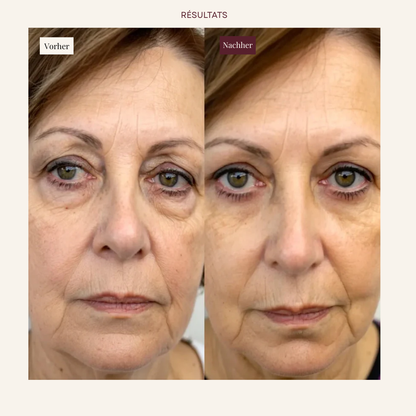 Élan EyeLift 2-in-1