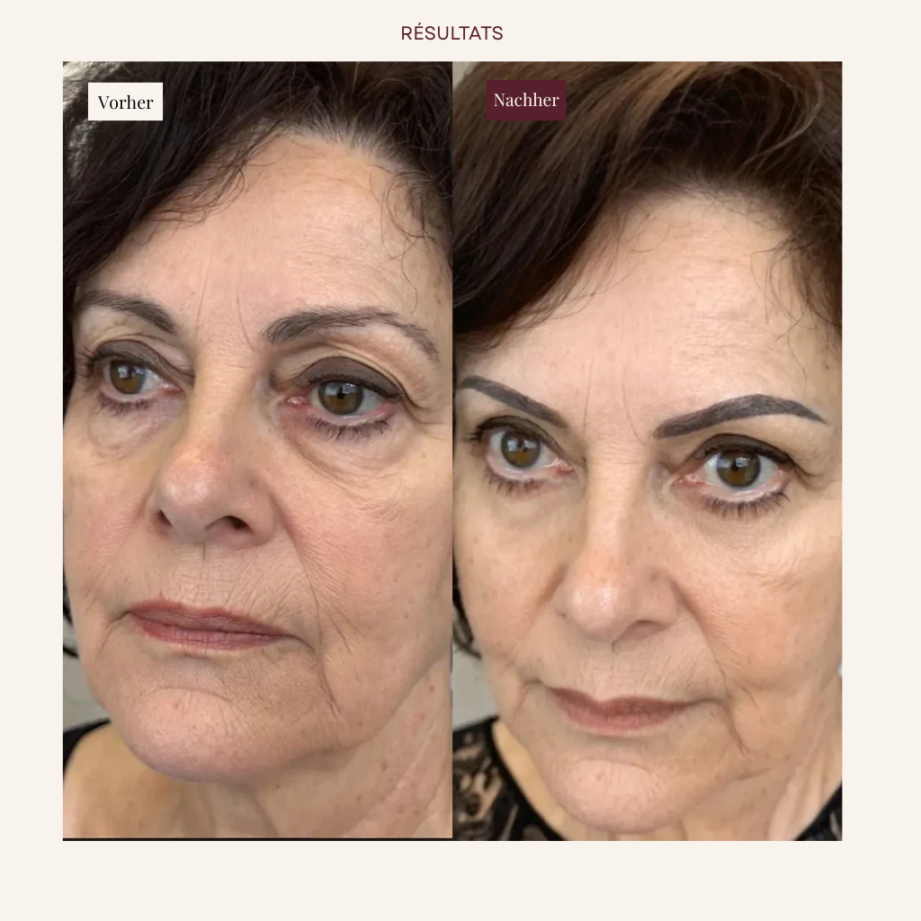 Élan EyeLift 2-in-1